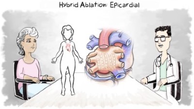 Enocardial ablation